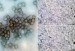 holubinka révová - mikroskopie (Dan Kvasnička)